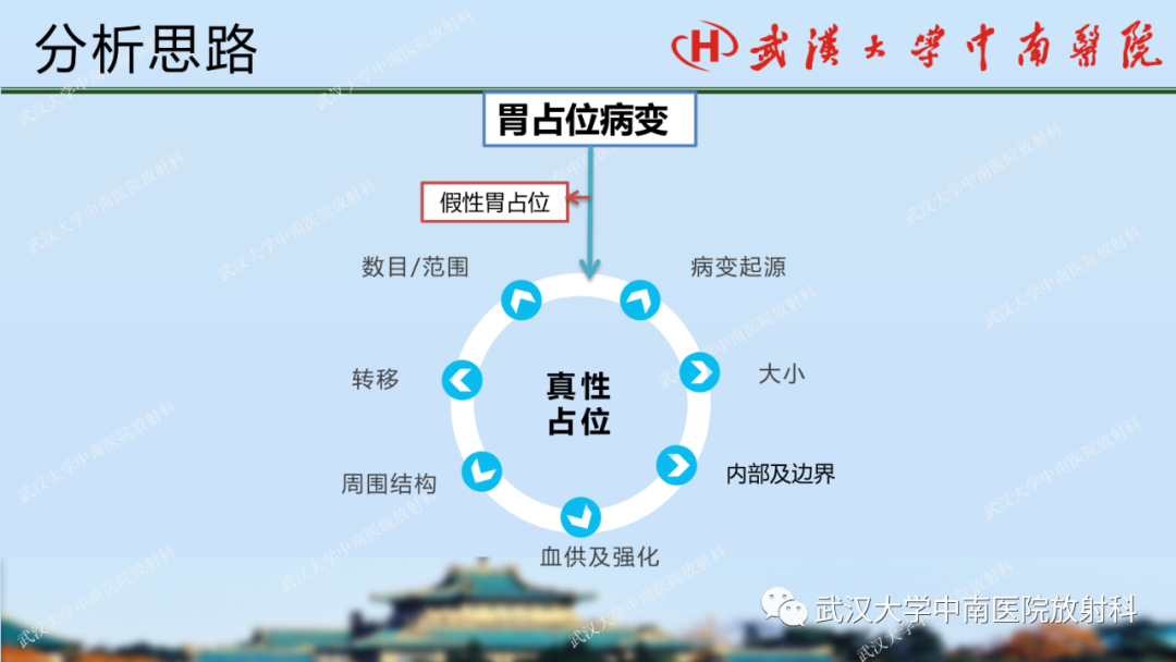 影像PPT - 【PPT】胃占位病变影像诊断分析-16