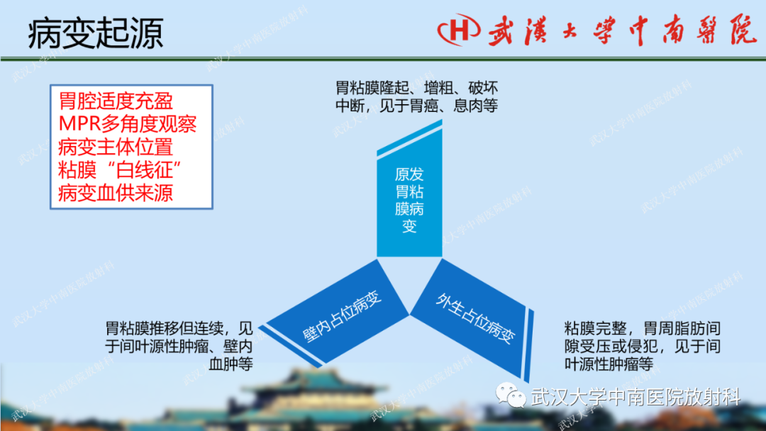 影像PPT - 【PPT】胃占位病变影像诊断分析-21