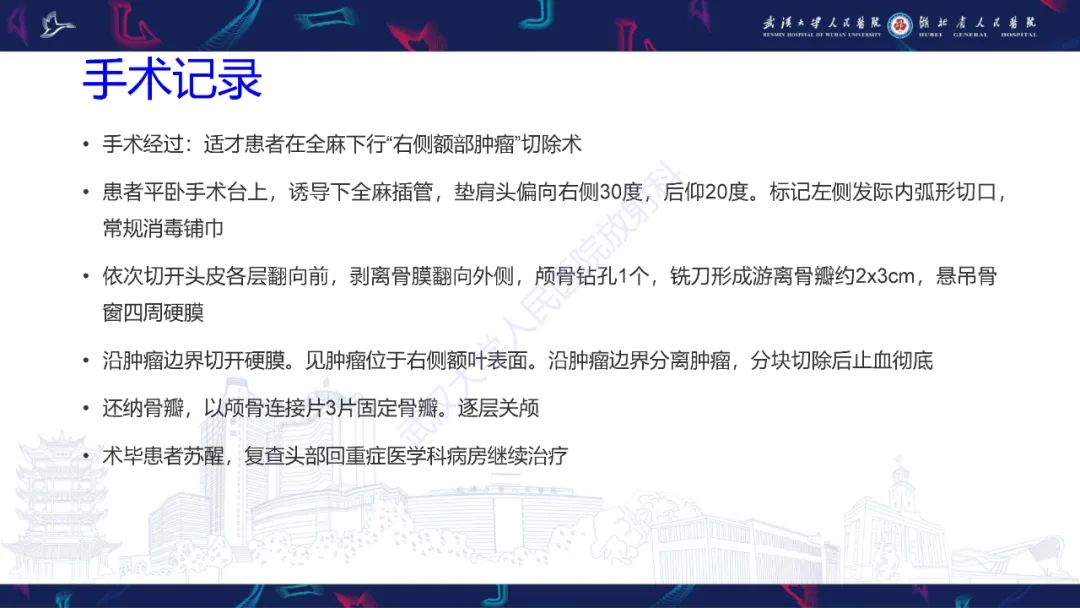 影像PPT - 【PPT】脑多形性黄色星形细胞瘤影像诊断-7