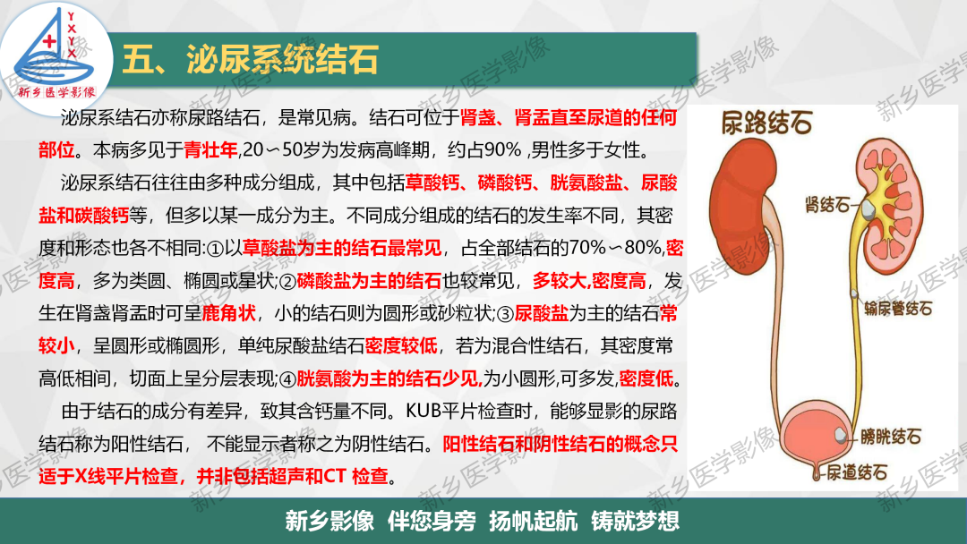 影像PPT - 【PPT】泌尿系结石的影像表现及诊断注意事项-3