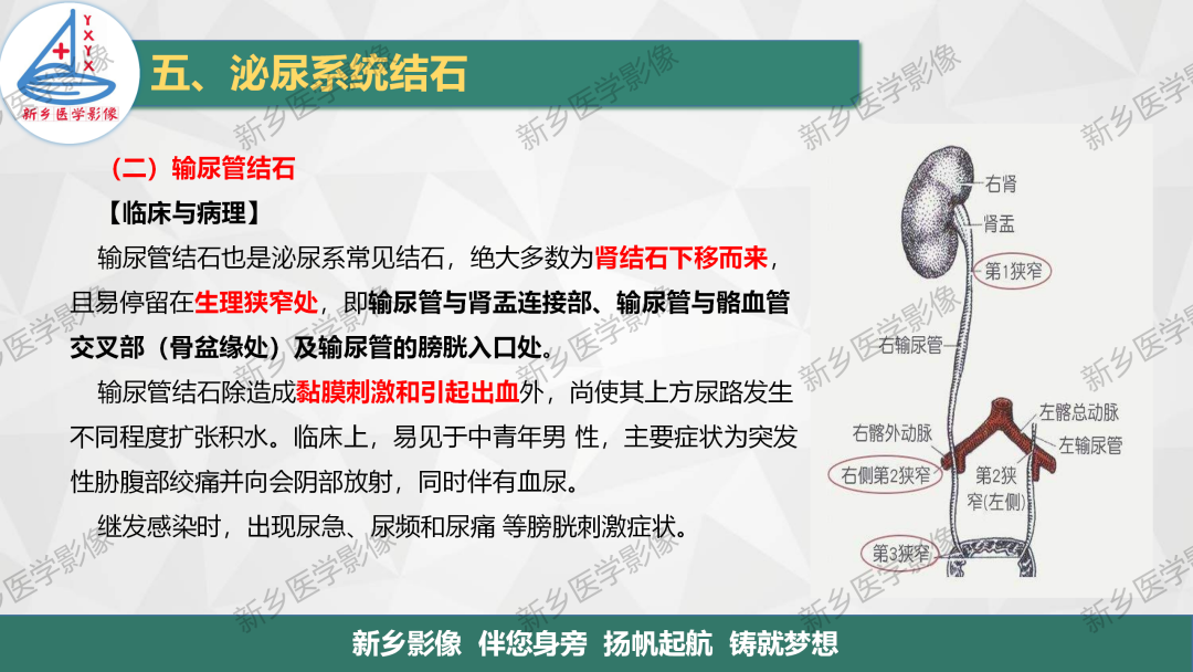 影像PPT - 【PPT】泌尿系结石的影像表现及诊断注意事项-9