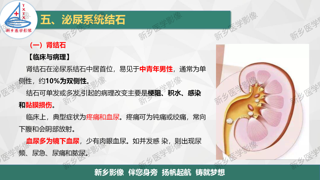 影像PPT - 【PPT】泌尿系结石的影像表现及诊断注意事项-1