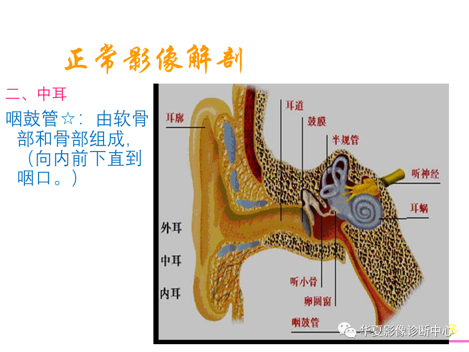 影像PPT - 【PPT】耳的影像解剖及常见疾病诊断-6