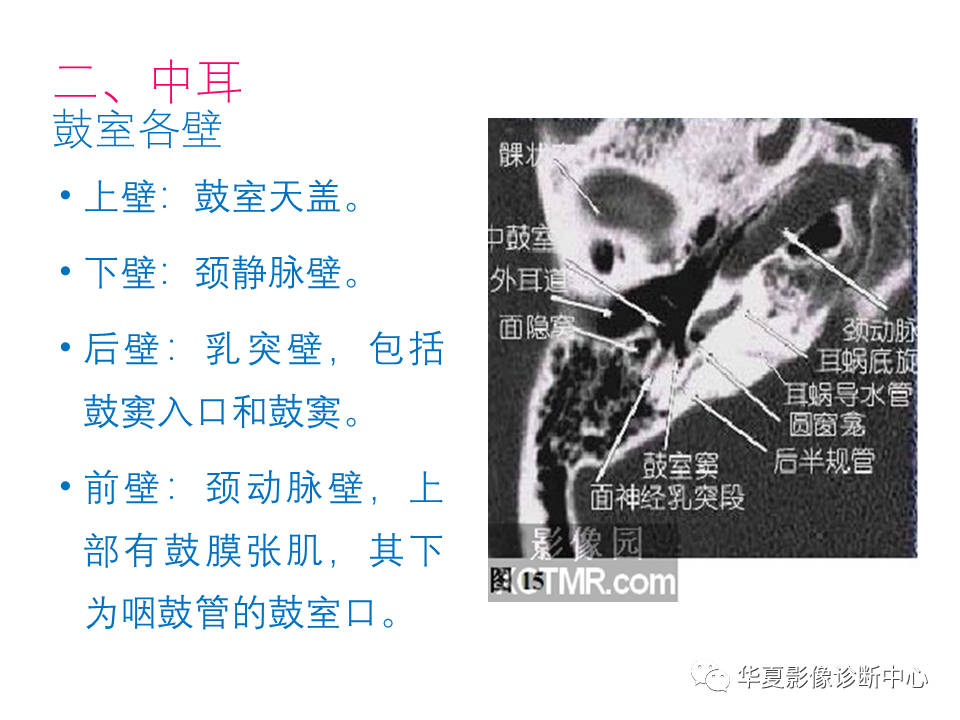 影像PPT - 【PPT】耳的影像解剖及常见疾病诊断-10