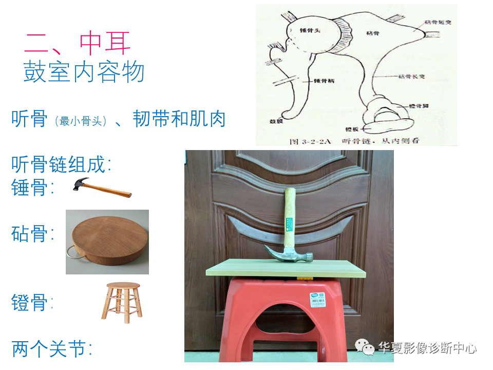 影像PPT - 【PPT】耳的影像解剖及常见疾病诊断-11