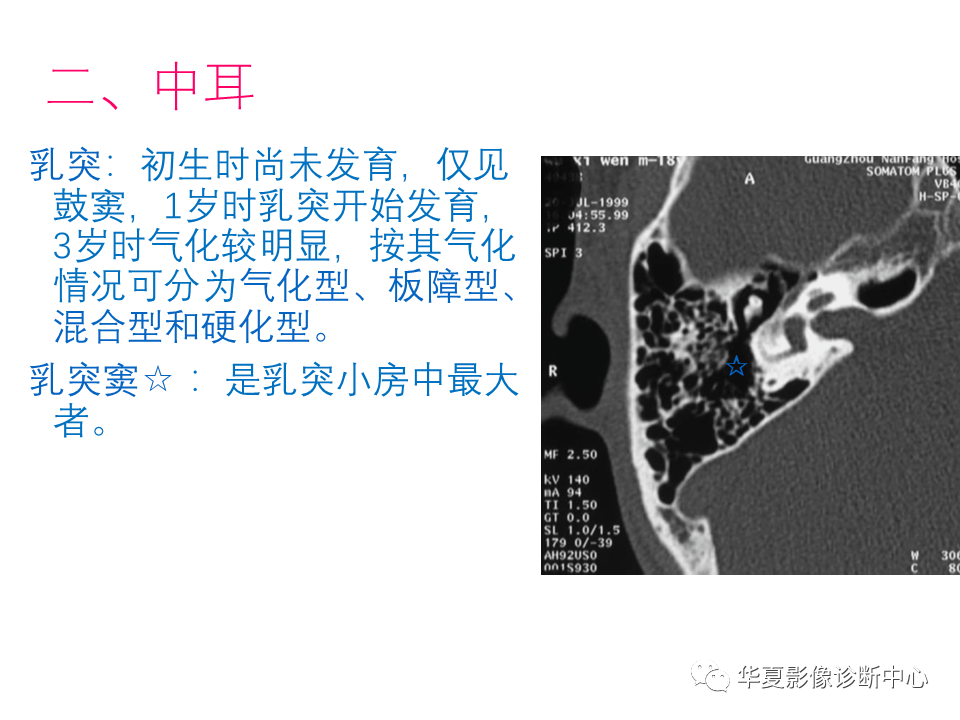 影像PPT - 【PPT】耳的影像解剖及常见疾病诊断-12