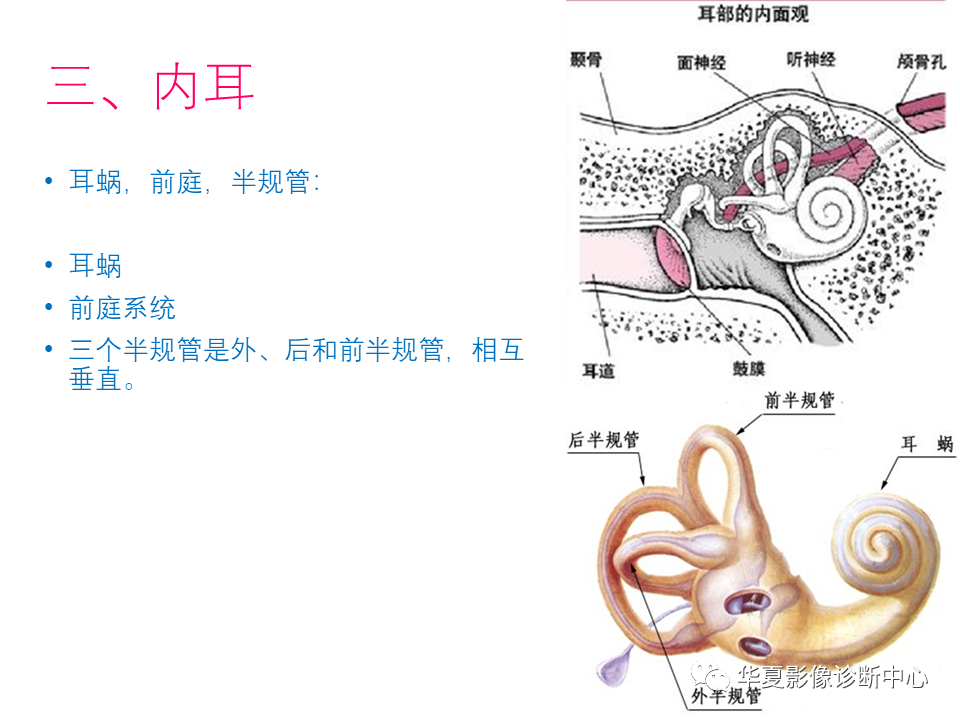 影像PPT - 【PPT】耳的影像解剖及常见疾病诊断-13