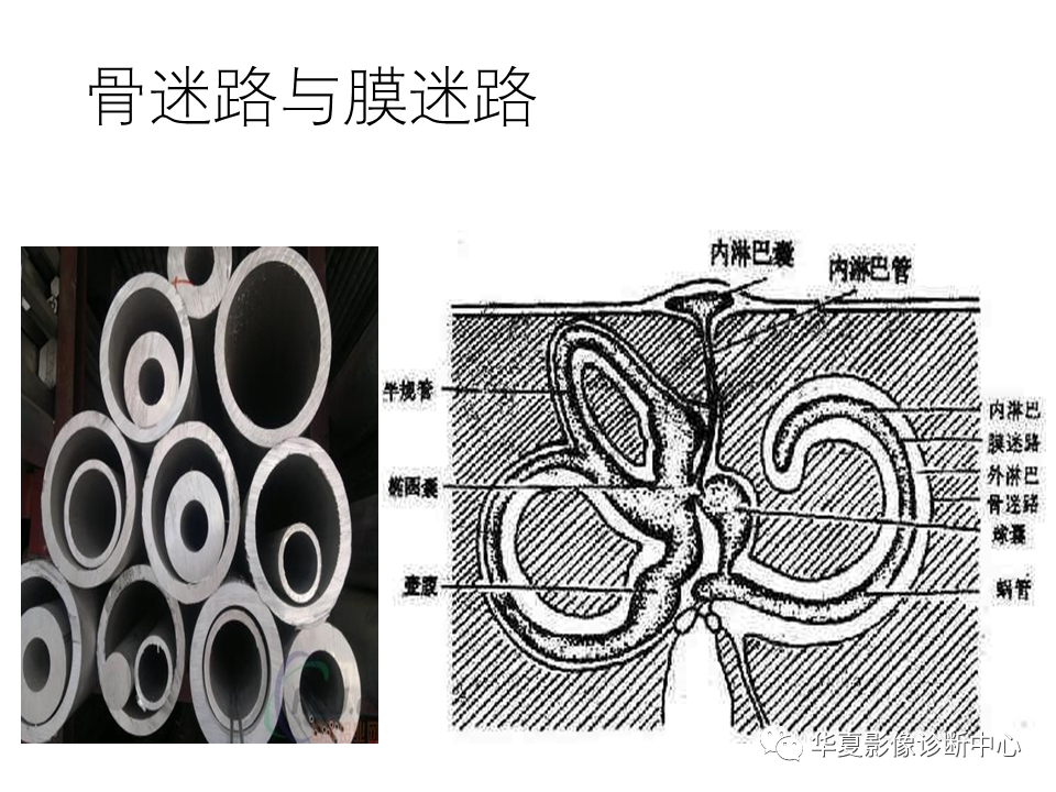 影像PPT - 【PPT】耳的影像解剖及常见疾病诊断-29