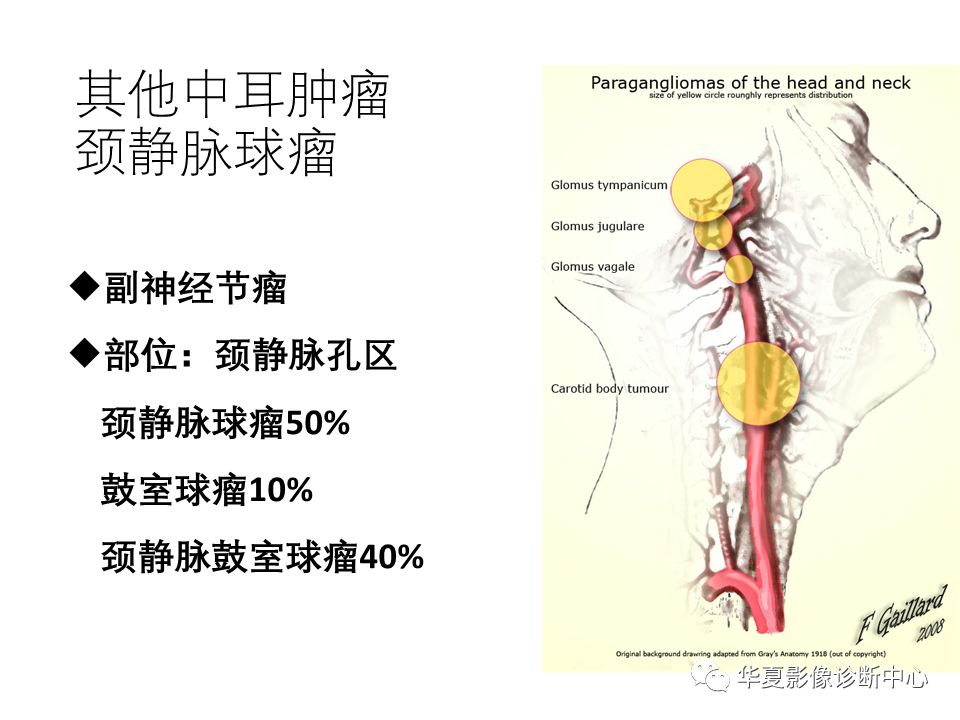 影像PPT - 【PPT】耳的影像解剖及常见疾病诊断-63