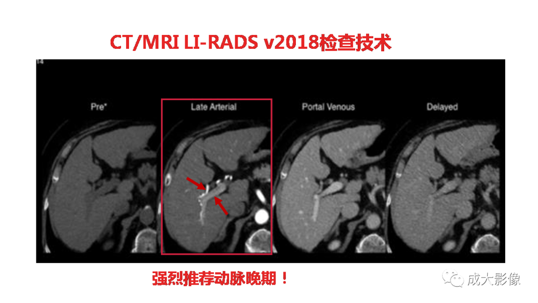 影像PPT - 【PPT】LI-RADS结构化报告实例应用-10