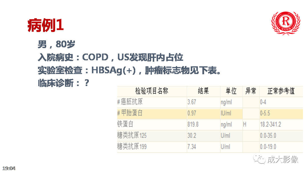 影像PPT - 【PPT】LI-RADS结构化报告实例应用-18