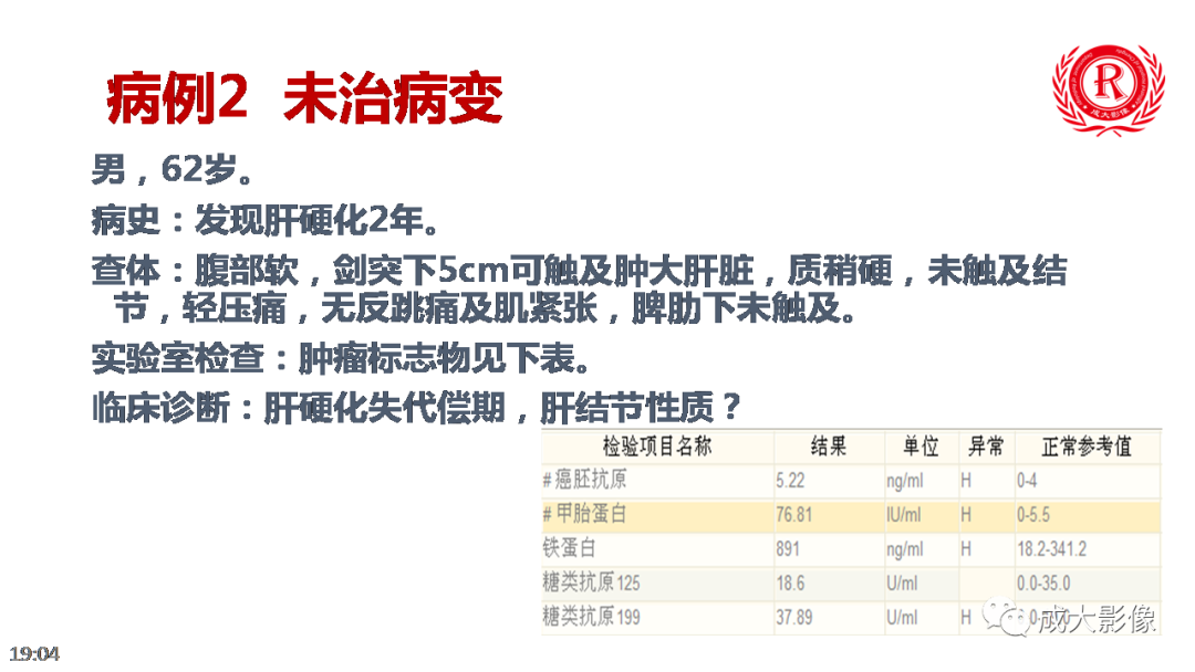 影像PPT - 【PPT】LI-RADS结构化报告实例应用-24