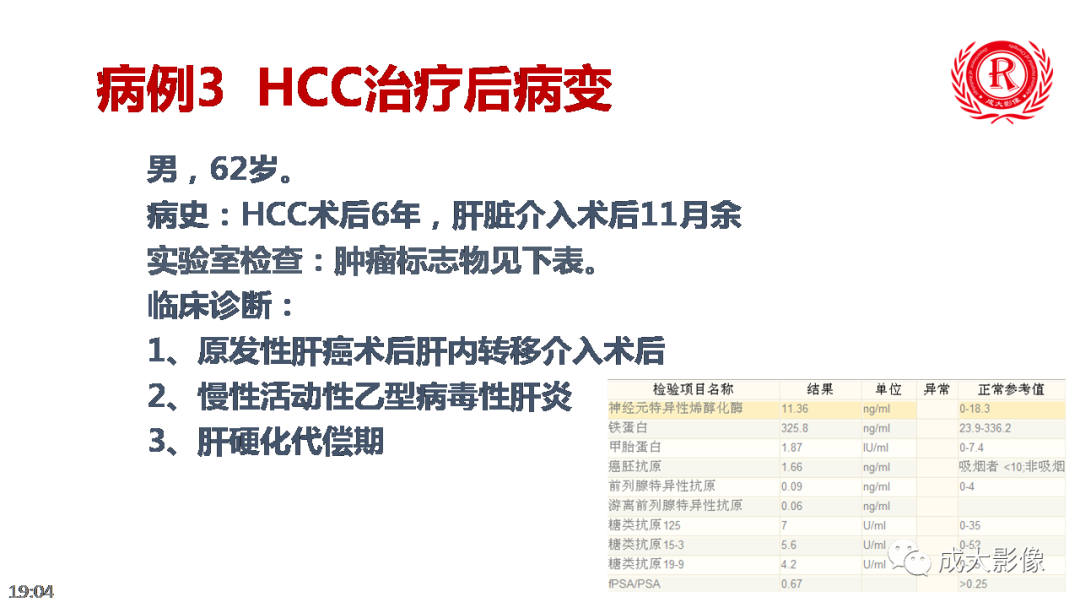 影像PPT - 【PPT】LI-RADS结构化报告实例应用-31