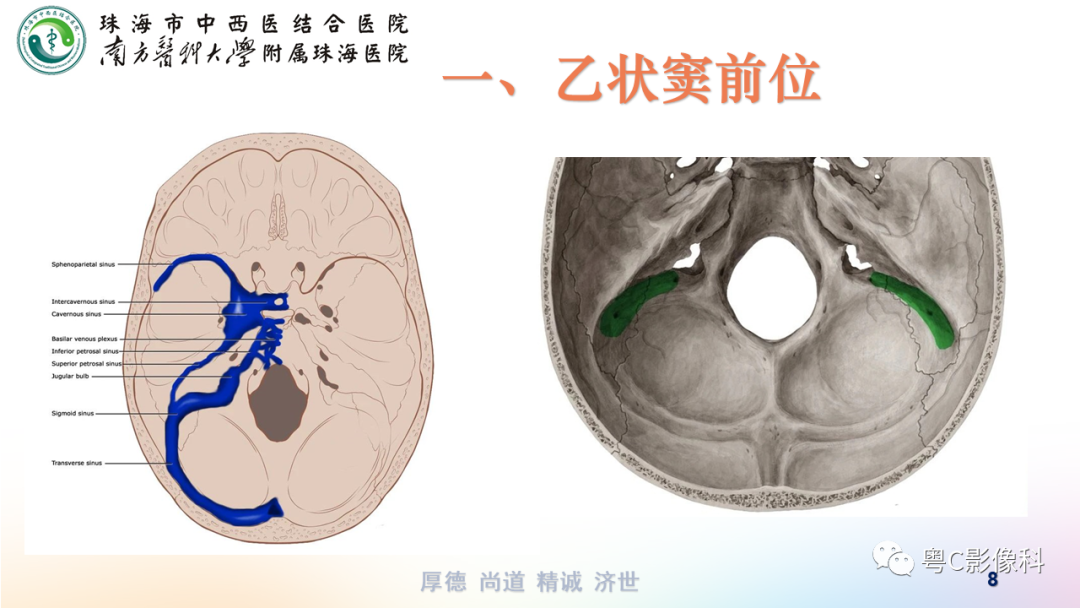 影像PPT - 【PPT】颞骨CT检查容易忽略的两个问题-8 影像PPT - 【PPT】颞骨CT检查容易忽略的两个问题-8