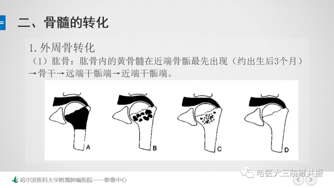 影像PPT - 【PPT】骨髓转化和再转化-26