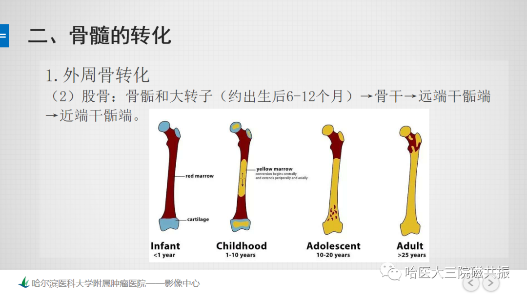 影像PPT - 【PPT】骨髓转化和再转化-29