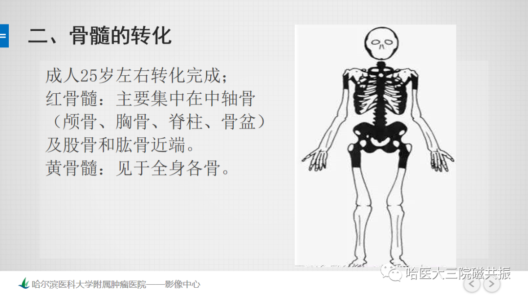 影像PPT - 【PPT】骨髓转化和再转化-45