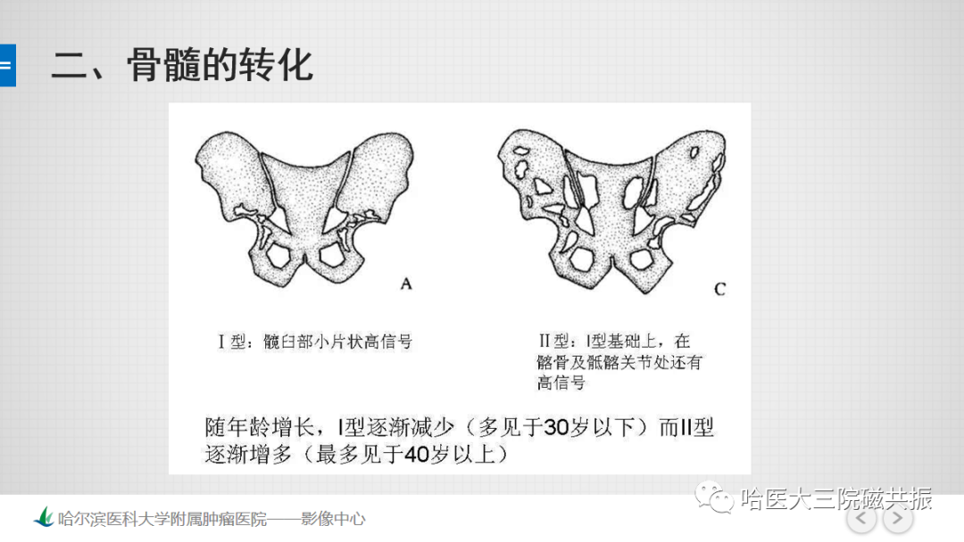 影像PPT - 【PPT】骨髓转化和再转化-43