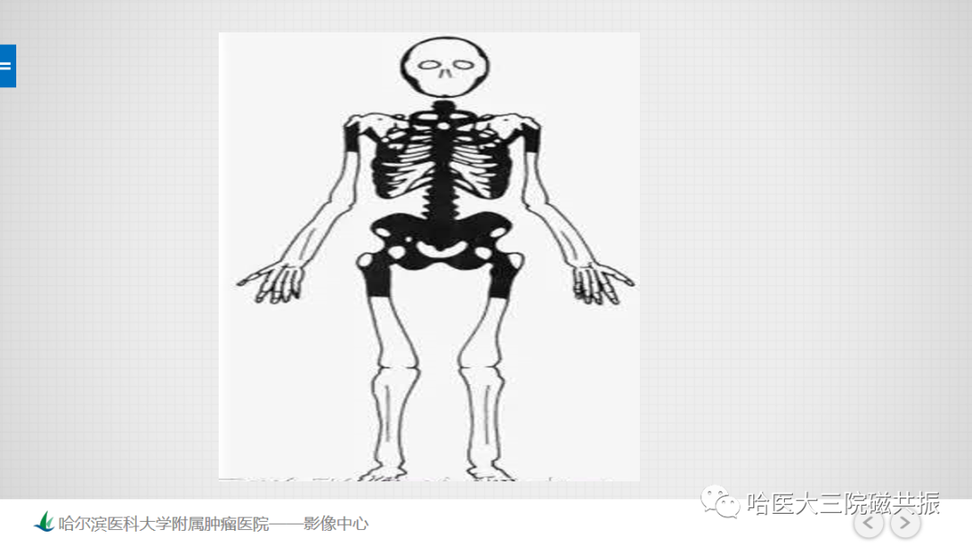 影像PPT - 【PPT】骨髓转化和再转化-55