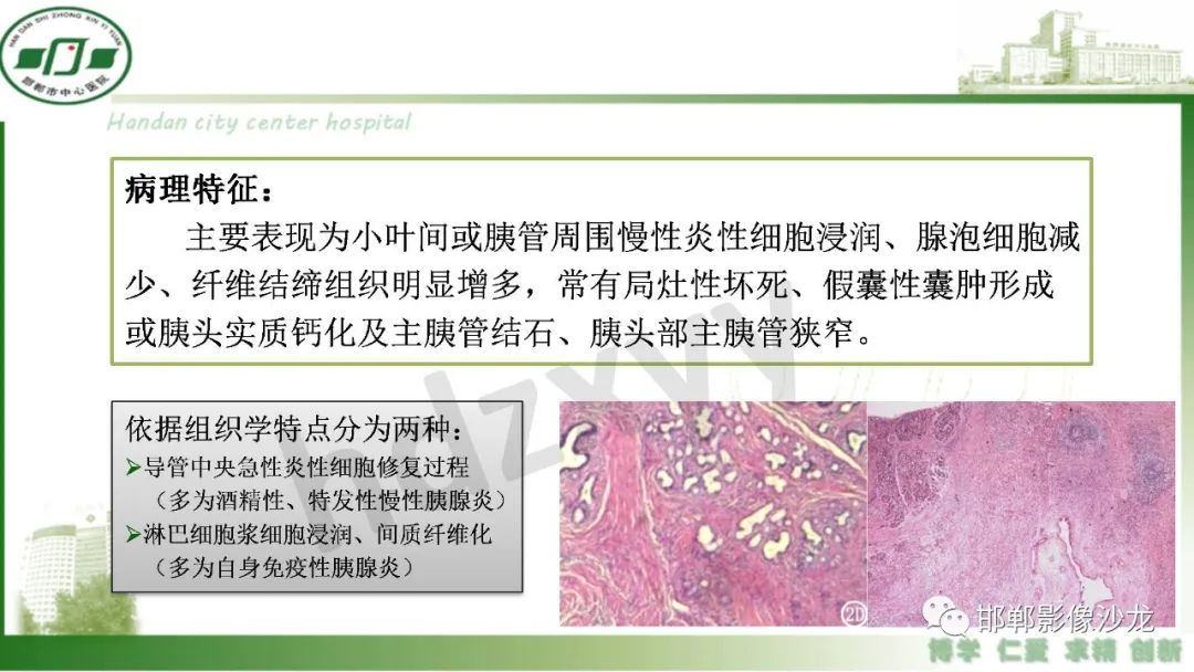 影像PPT - 【PPT】肿块性胰腺炎-4