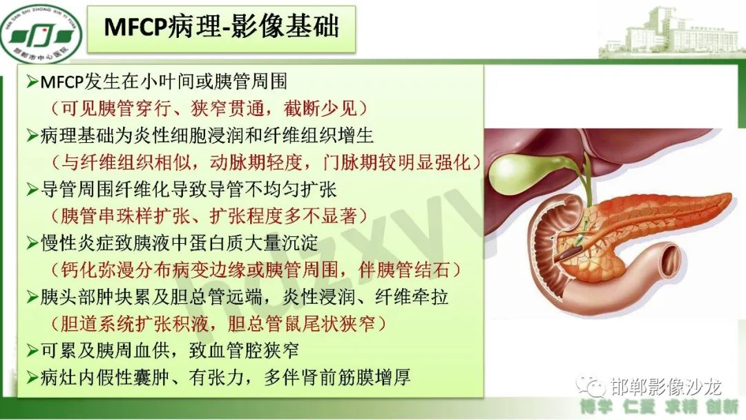 影像PPT - 【PPT】肿块性胰腺炎-7
