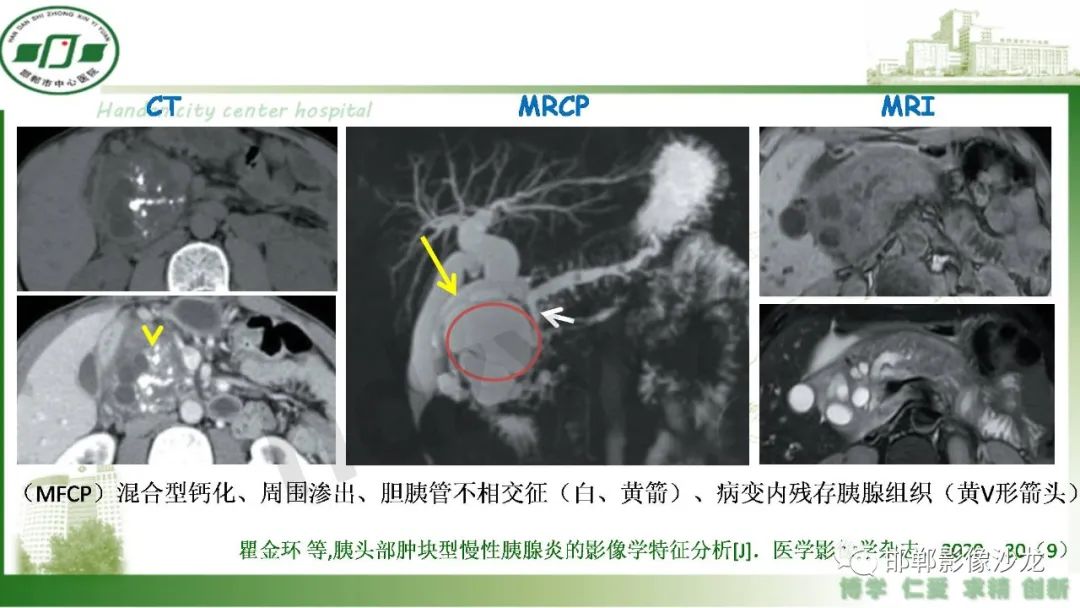 影像PPT - 【PPT】肿块性胰腺炎-9