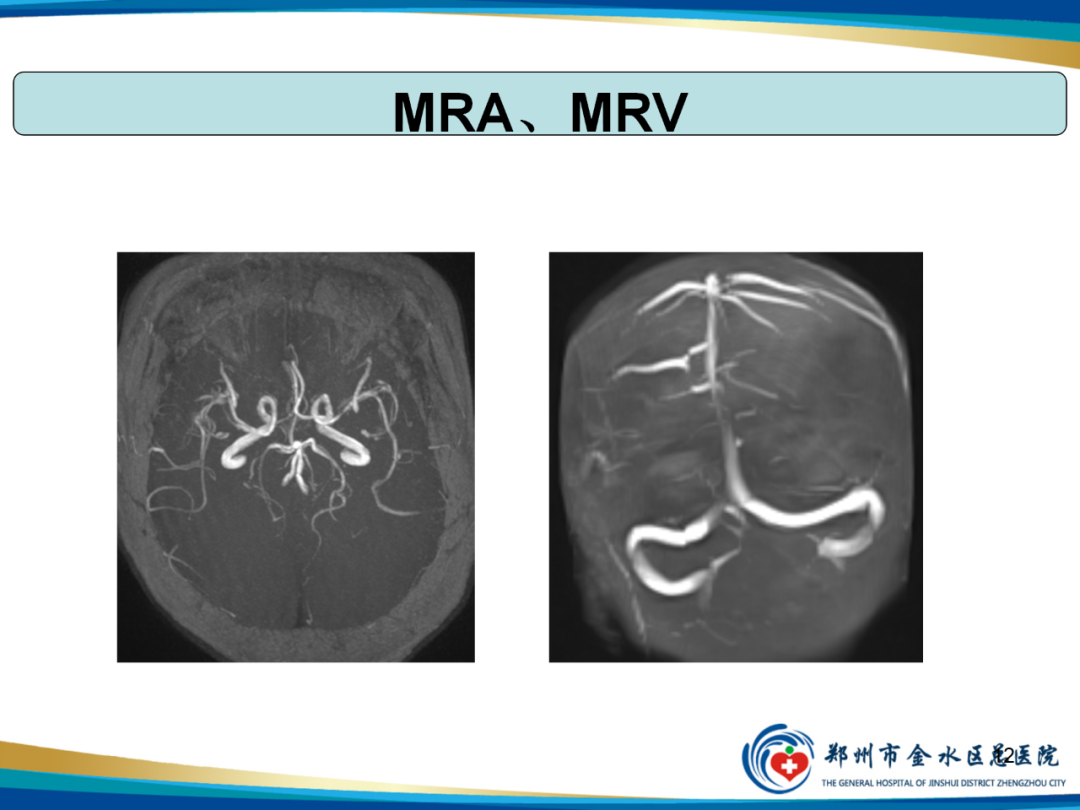 影像PPT - 【PPT】非典型脑膜瘤影像学诊断-12
