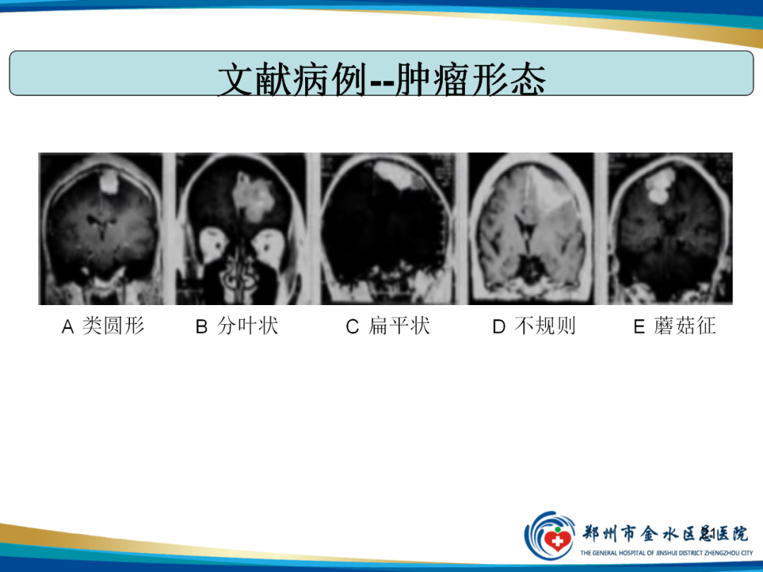 影像PPT - 【PPT】非典型脑膜瘤影像学诊断-21