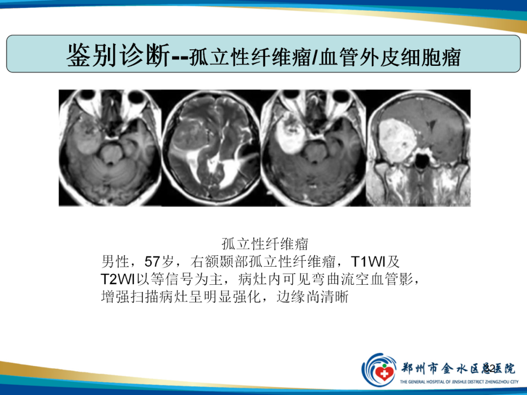 影像PPT - 【PPT】非典型脑膜瘤影像学诊断-32