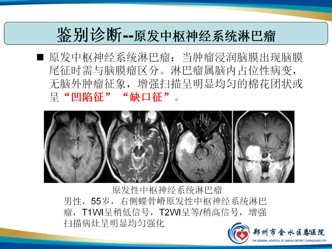 影像PPT - 【PPT】非典型脑膜瘤影像学诊断-35