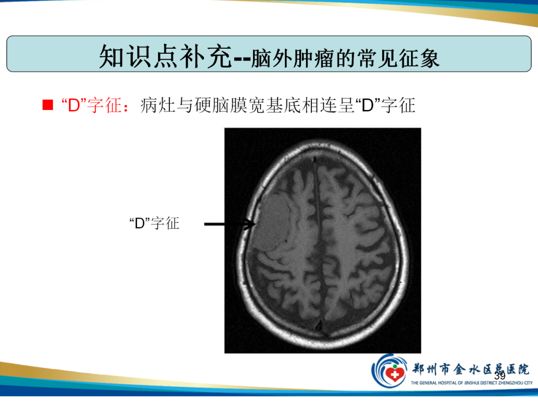 影像PPT - 【PPT】非典型脑膜瘤影像学诊断-39
