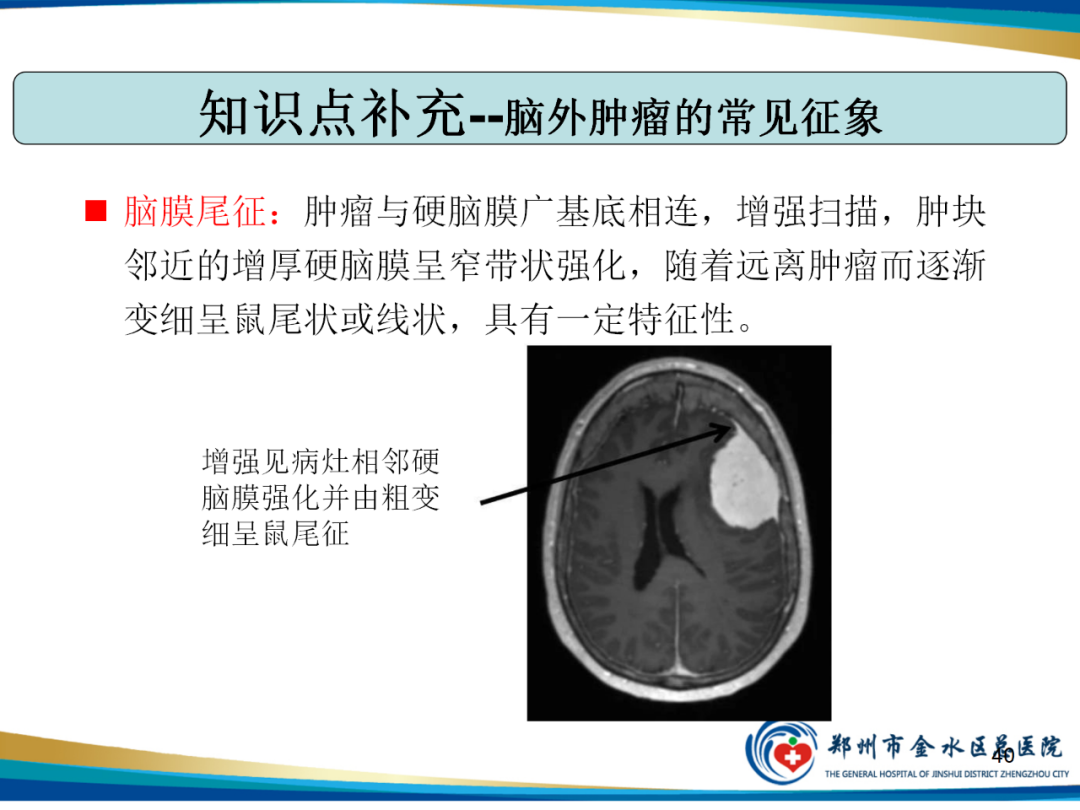 影像PPT - 【PPT】非典型脑膜瘤影像学诊断-40