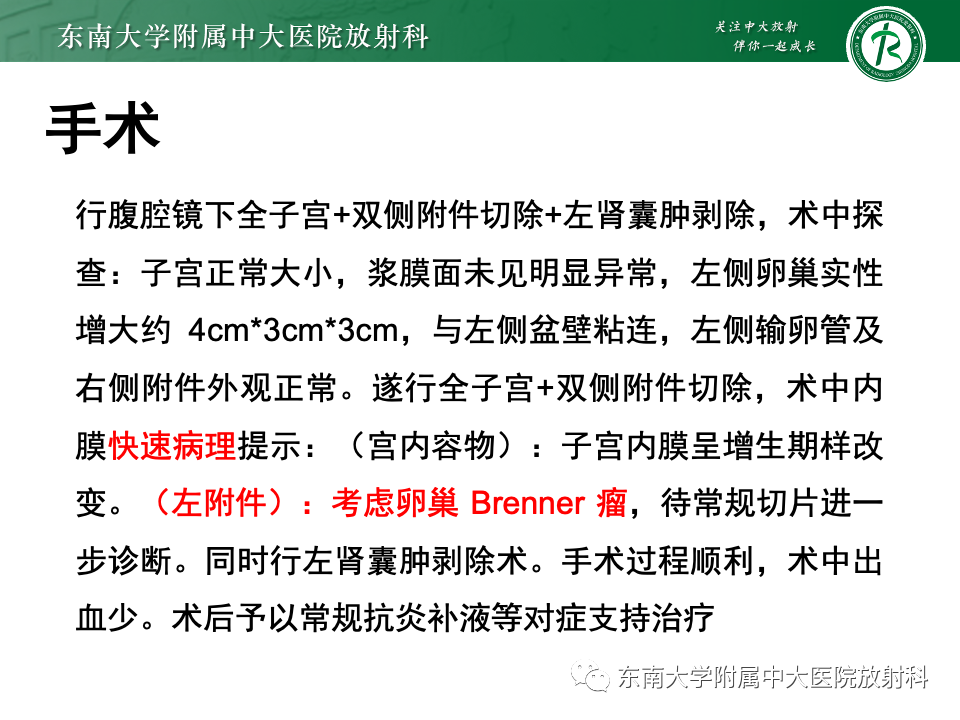 影像PPT - 【PPT】卵巢纤维上皮瘤(Brenner瘤)-7 影像PPT - 【PPT】卵巢纤维上皮瘤(Brenner瘤)-7