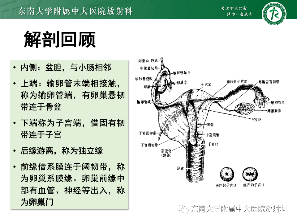 影像PPT - 【PPT】卵巢纤维上皮瘤(Brenner瘤)-10 影像PPT - 【PPT】卵巢纤维上皮瘤(Brenner瘤)-10