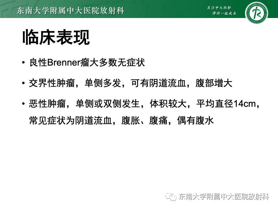 影像PPT - 【PPT】卵巢纤维上皮瘤(Brenner瘤)-16 影像PPT - 【PPT】卵巢纤维上皮瘤(Brenner瘤)-16
