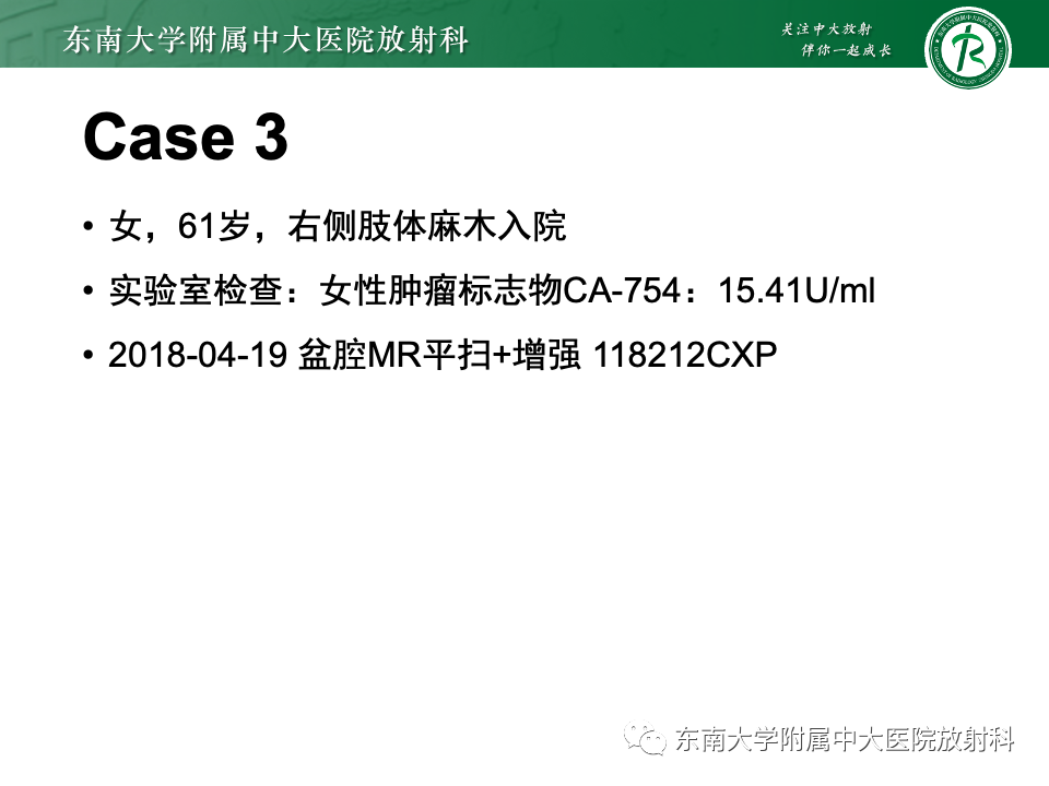 影像PPT - 【PPT】卵巢纤维上皮瘤(Brenner瘤)-22 影像PPT - 【PPT】卵巢纤维上皮瘤(Brenner瘤)-22