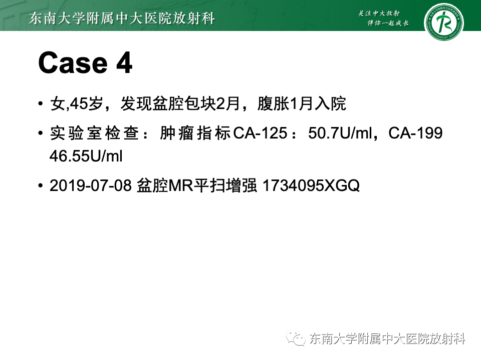 影像PPT - 【PPT】卵巢纤维上皮瘤(Brenner瘤)-26 影像PPT - 【PPT】卵巢纤维上皮瘤(Brenner瘤)-26