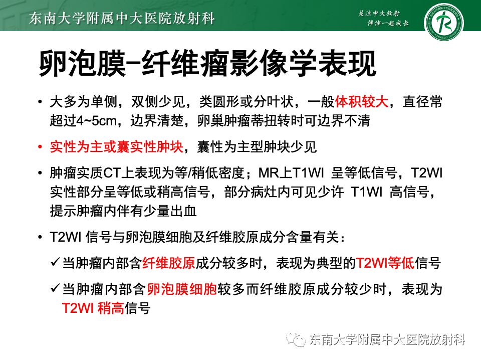 影像PPT - 【PPT】卵巢纤维上皮瘤(Brenner瘤)-29 影像PPT - 【PPT】卵巢纤维上皮瘤(Brenner瘤)-29