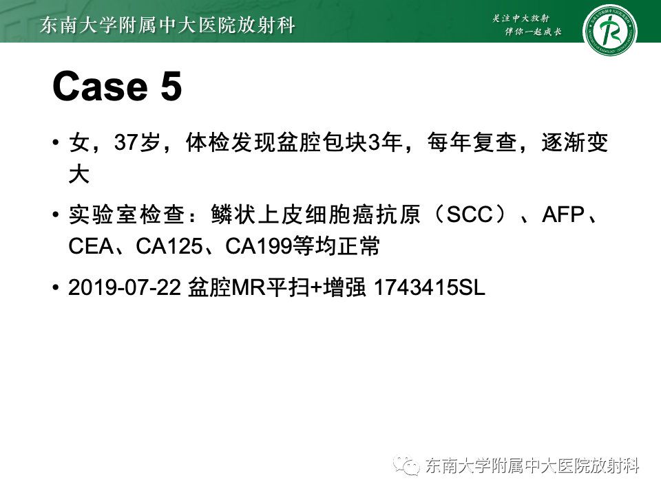 影像PPT - 【PPT】卵巢纤维上皮瘤(Brenner瘤)-32 影像PPT - 【PPT】卵巢纤维上皮瘤(Brenner瘤)-32