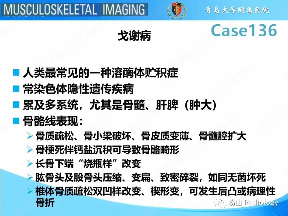 影像PPT - 【PPT】发育性髋关节发育不良-8