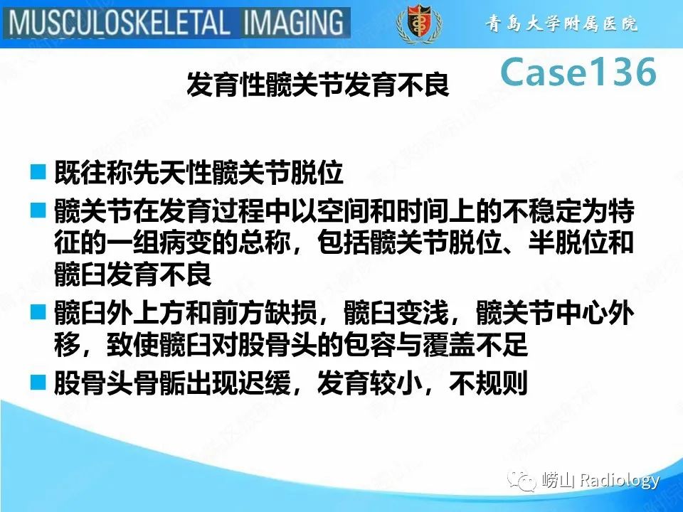 影像PPT - 【PPT】发育性髋关节发育不良-11