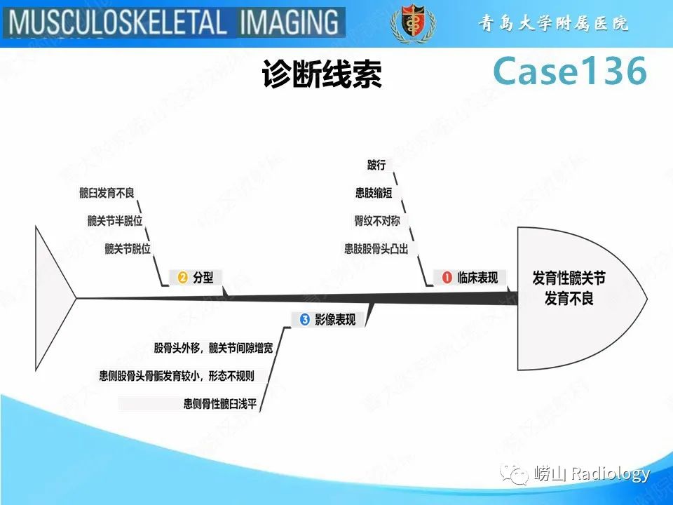 影像PPT - 【PPT】发育性髋关节发育不良-28