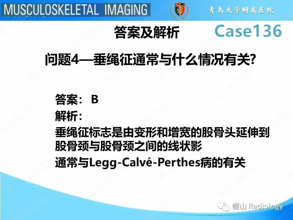 影像PPT - 【PPT】发育性髋关节发育不良-26