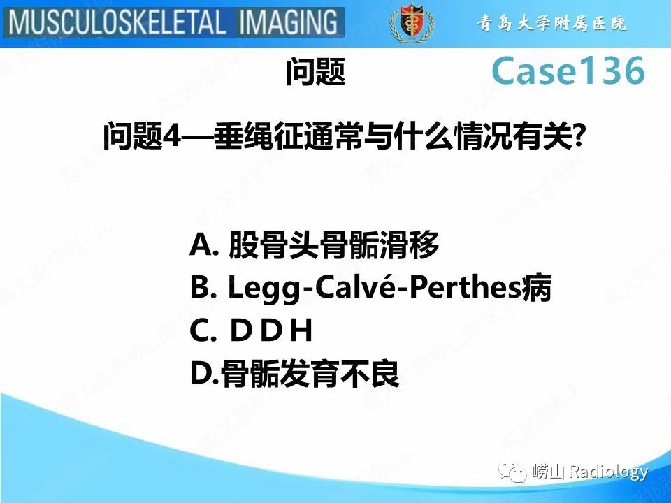 影像PPT - 【PPT】发育性髋关节发育不良-25