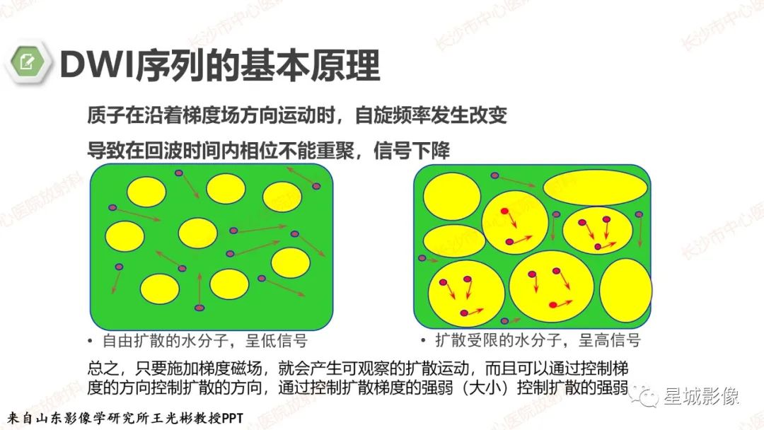 影像PPT - 【PPT】DWI序列判读原则及临床应用-5