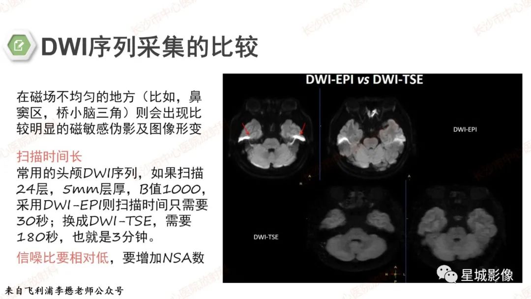 影像PPT - 【PPT】DWI序列判读原则及临床应用-11