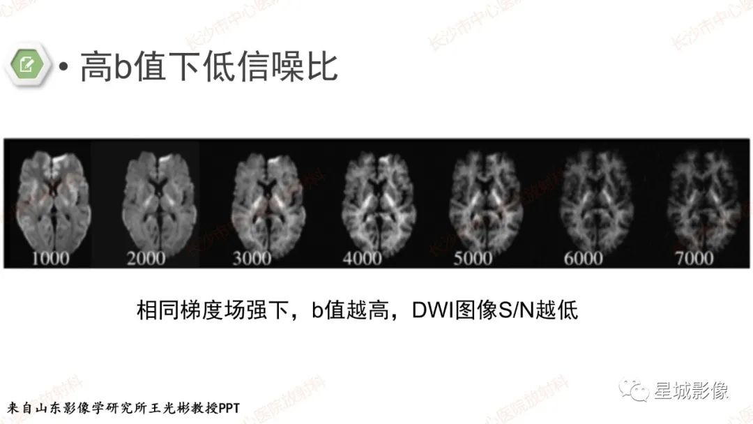 影像PPT - 【PPT】DWI序列判读原则及临床应用-15