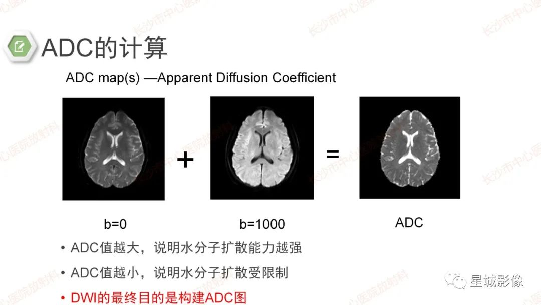 影像PPT - 【PPT】DWI序列判读原则及临床应用-17