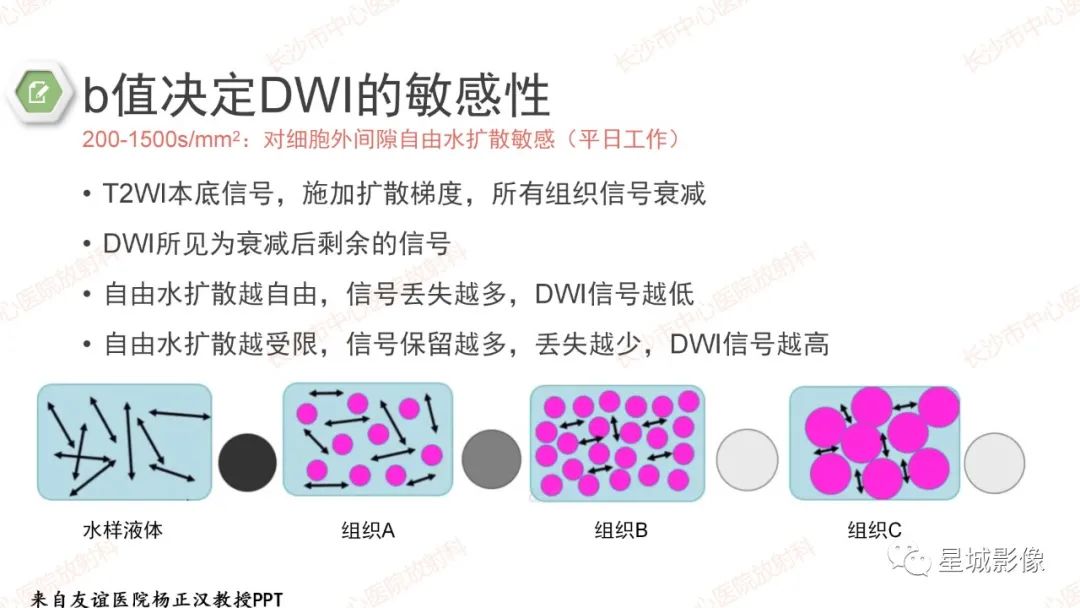影像PPT - 【PPT】DWI序列判读原则及临床应用-19