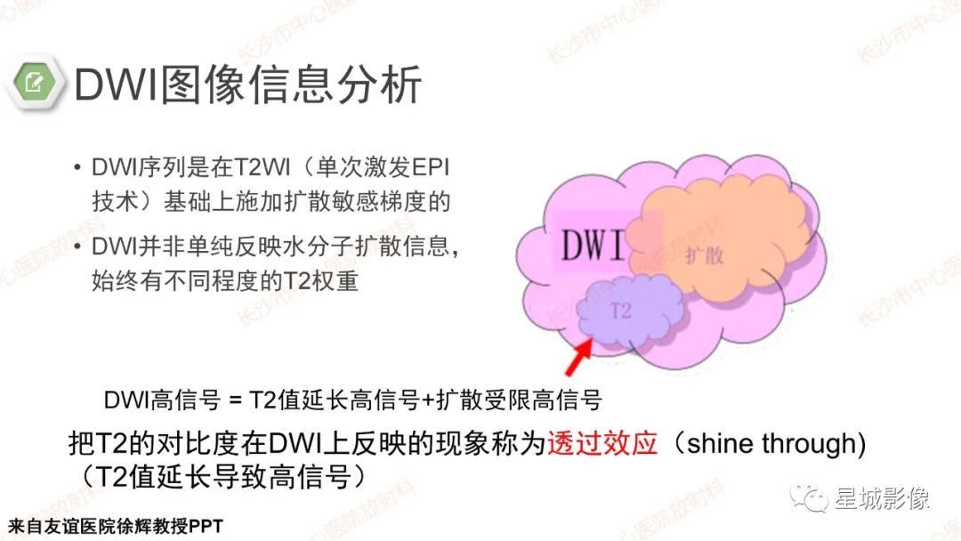 影像PPT - 【PPT】DWI序列判读原则及临床应用-20